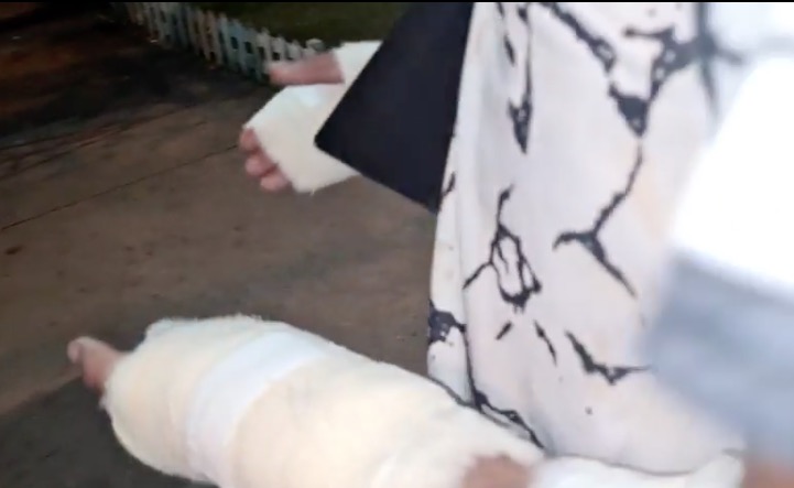 Dupla suspeita de roubo leva tiros nas mãos no Amazonas