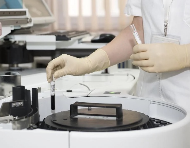 Distrito Federal confirma um caso de raiva humana