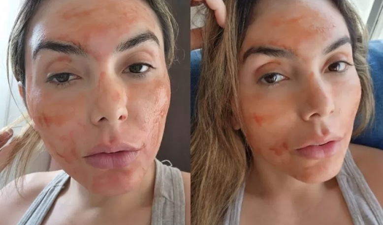 Musa do OnlyFans usa sangue menstrual como máscara facial; Veja