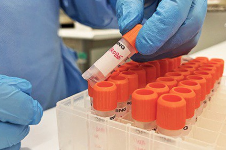 Amazonas chega a 55 casos confirmados de varíola dos macacos