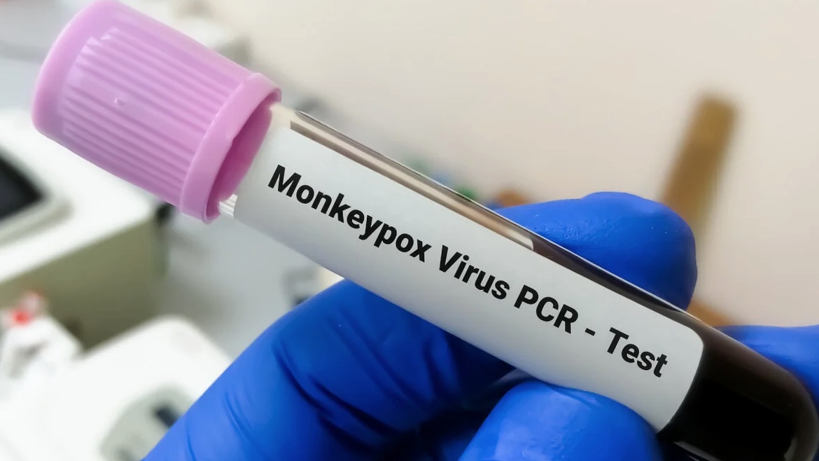 Em uma semana, casos de varíola dos macacos sobem 77% no Amazonas 
