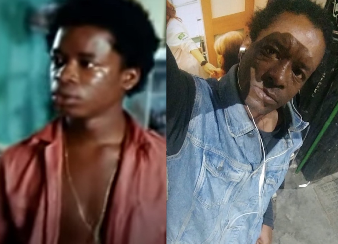 Ator de ‘Cidade de Deus’ vive em situação de rua e revela drama após filme