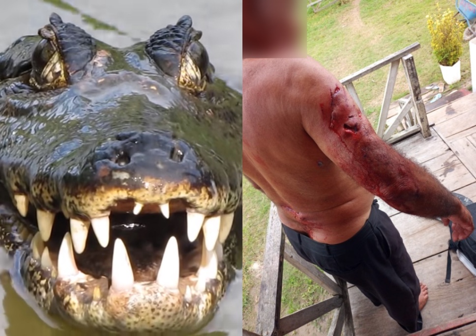 Homem é atacado por jacaré em Manacapuru; Imagens fortes