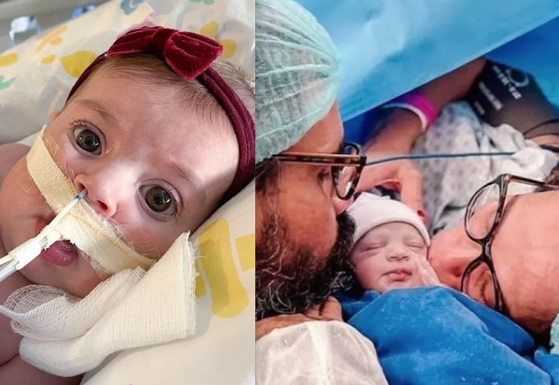 Aos 3 meses, filha de Juliano Cazarré fará nova cirurgia 