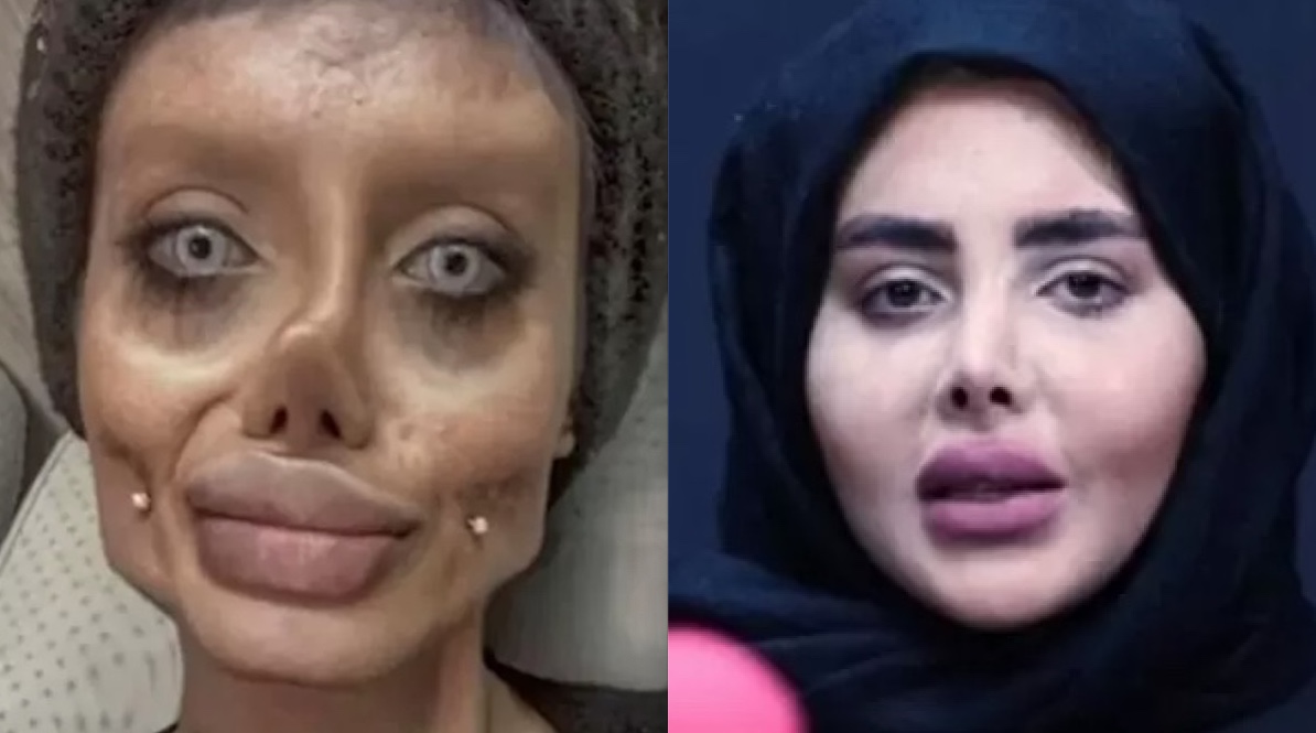 'Angelina Jolie Zumbi' deixa prisão após 3 anos e revela verdadeiro rosto