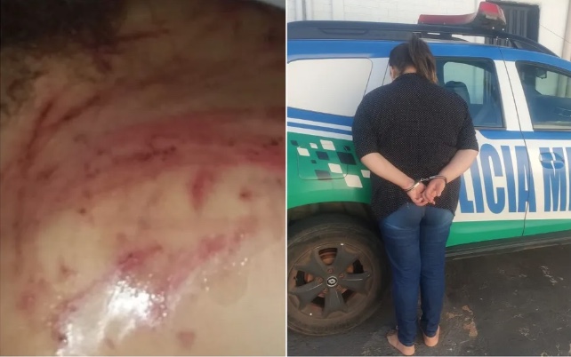 Mãe é presa por torturar filha de 8 anos após 'bagunçar' a casa