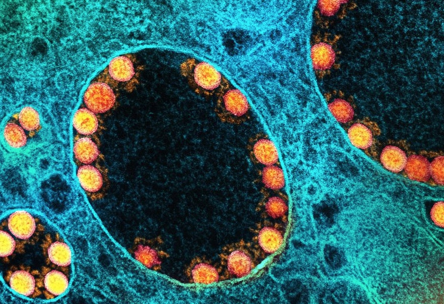 Fiocruz aponta aumento de casos de Covid no Amazonas e mais 11 estados