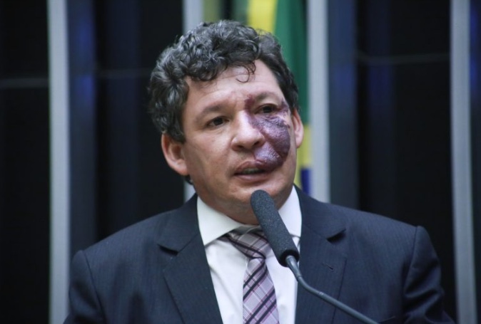 Bolsa Família fora do teto por 1 ano é irresponsabilidade, diz líder do PT