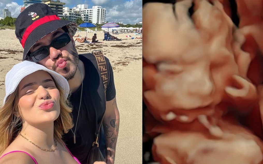 Viih Tube mostra rostinho da filha com Eliezer em ultrassom 3D 