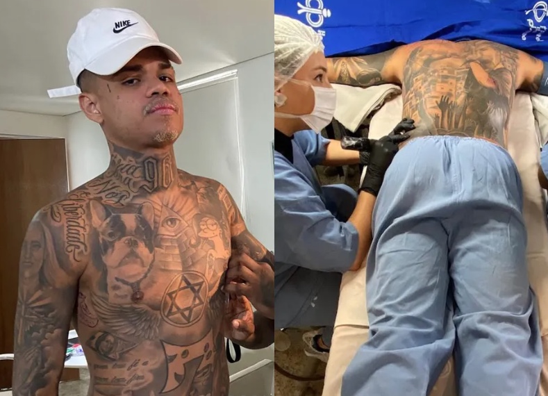 MC Cabelinho toma anestesia geral para terminar tatuagem nas costas