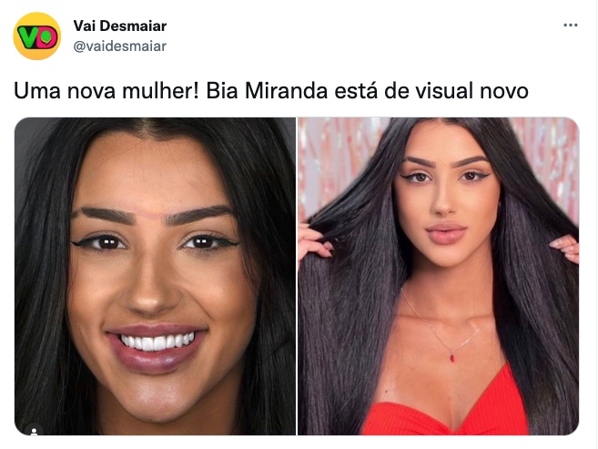 Ex-A Fazenda Bia Miranda surge bem diferente após combo de procedimentos