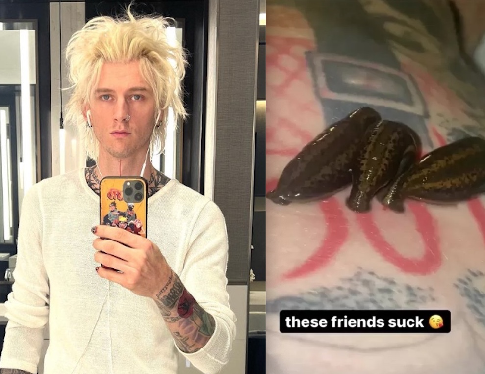 Noivo da atriz Megan Fox choca ao surgir com sanguessugas na barriga