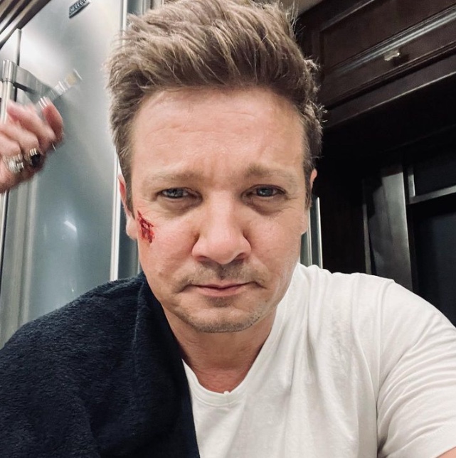Jeremy Renner gemia de dor em ligação para a emergência após ser esmagado