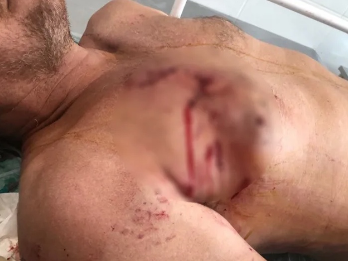 Jacaré ataca e arrasta pescador para o fundo do rio