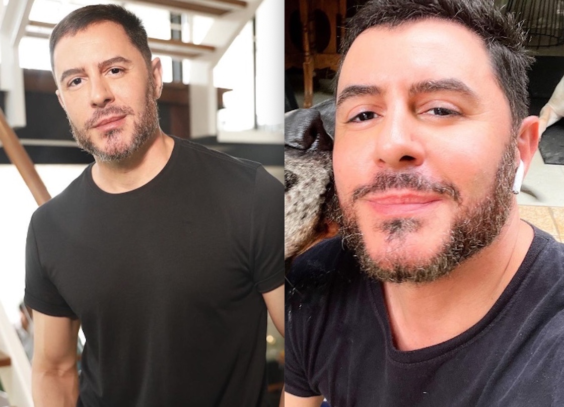 Ator Ricardo Tozzi surge irreconhecível e web reage: 'o que aconteceu?'