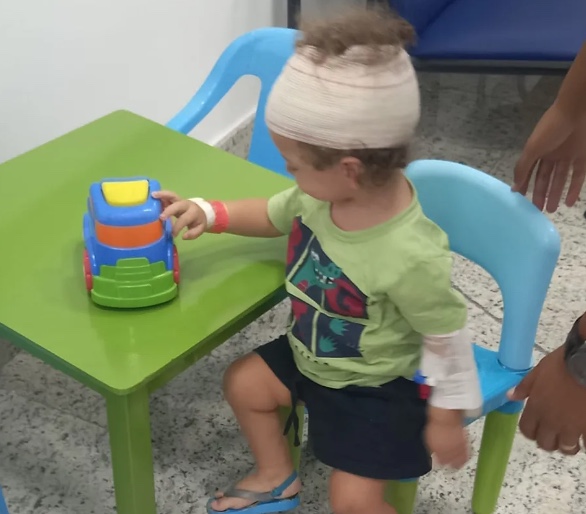 Menino tem parte do rosto dilacerado após ataque de cachorro