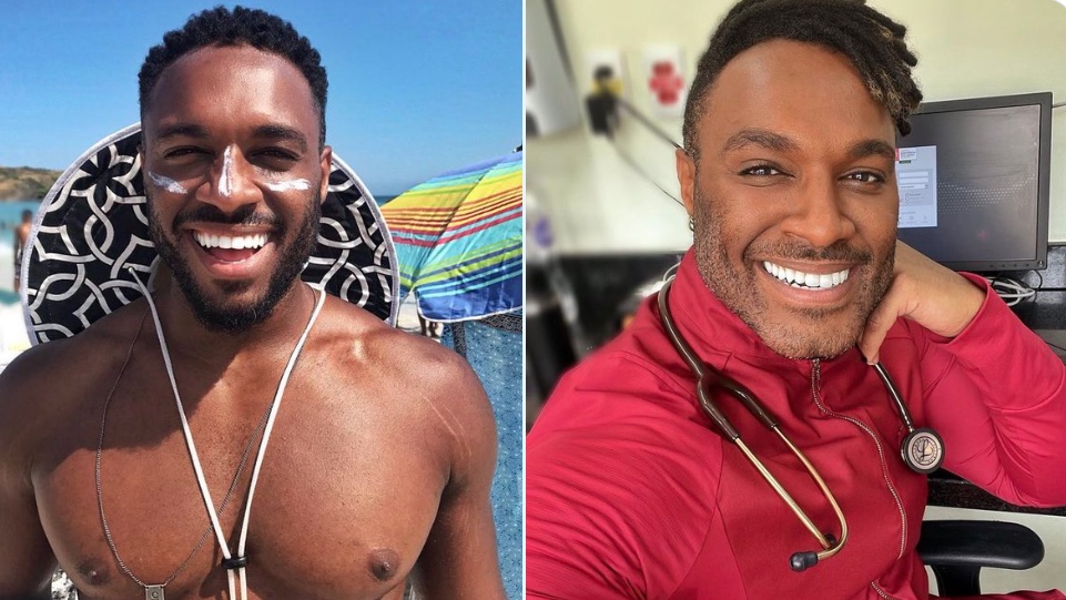 Fotos de Fred Nicácio antes da harmonização facial impressionam internautas