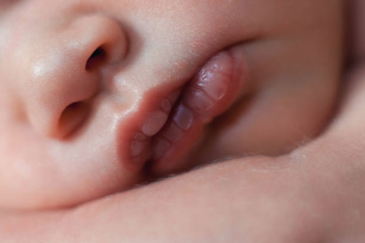 Bebê de 9 meses é intoxicada após comer maconha da mãe