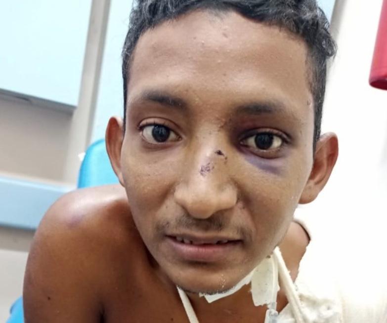 Hospital busca por familiares de paciente espancado em Manaus