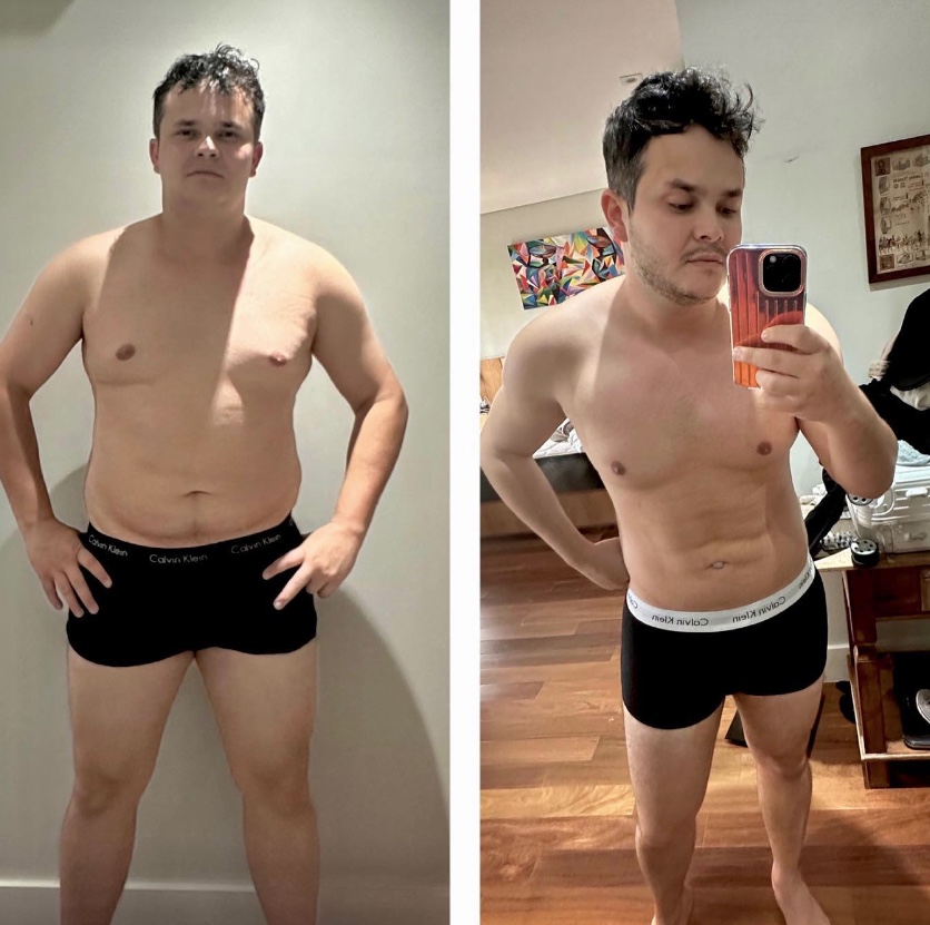 Matheus, da dupla com Kauan, surge sarado e mostra resultado de LipoHD