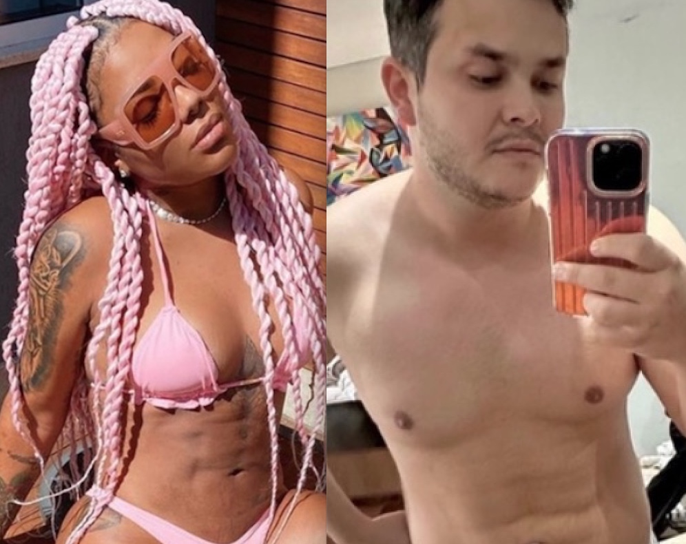 Lipo LAD: Saiba como funciona a cirurgia plástica queridinha dos famosos 