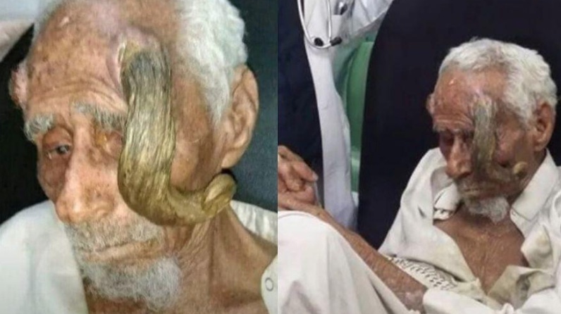 Idoso de 140 anos morre após desconhecido tentar arrancas seus 'chifres'