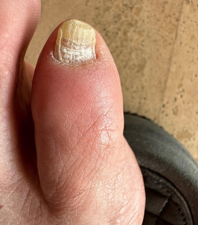 Chris Pratt choca fãs com foto da unha do pé horrenda: ‘nojo’