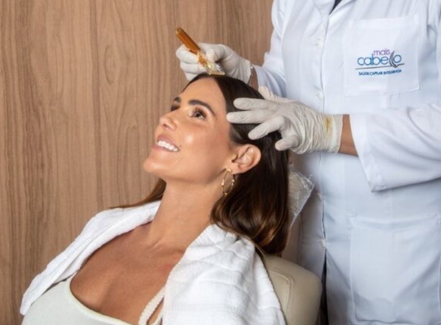 Tratamentos capilares ajudam pacientes com calvície em Manaus