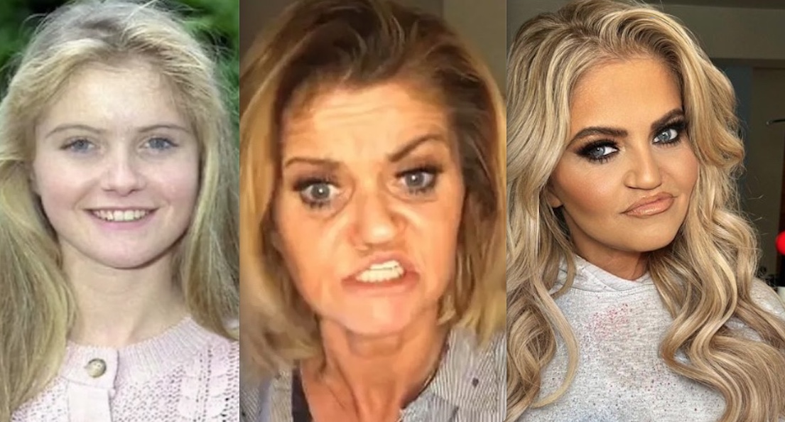 Atriz com rosto corroído por cocaína fará cirurgia para evitar morte