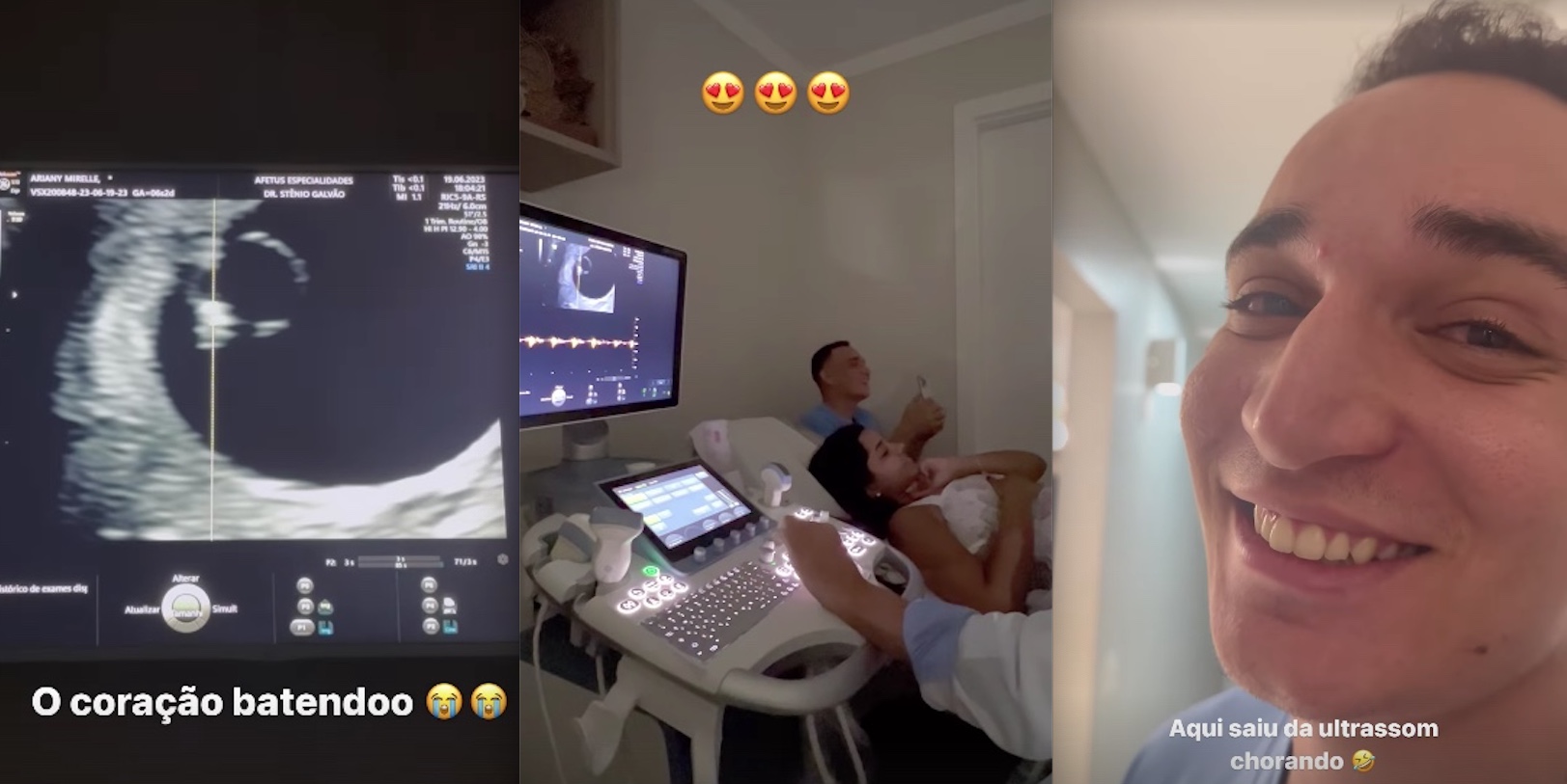 João Gomes se emociona com ultrassom do filho com Ary Mirelle