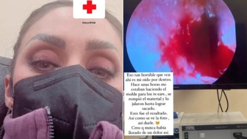 Anahí perfura tímpano durante preparativos para turnê do RBD