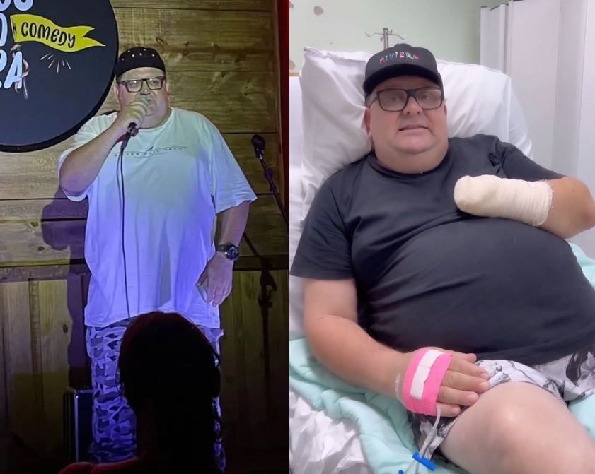 Influencer tem mão amputada após acidente com fogos de artifício