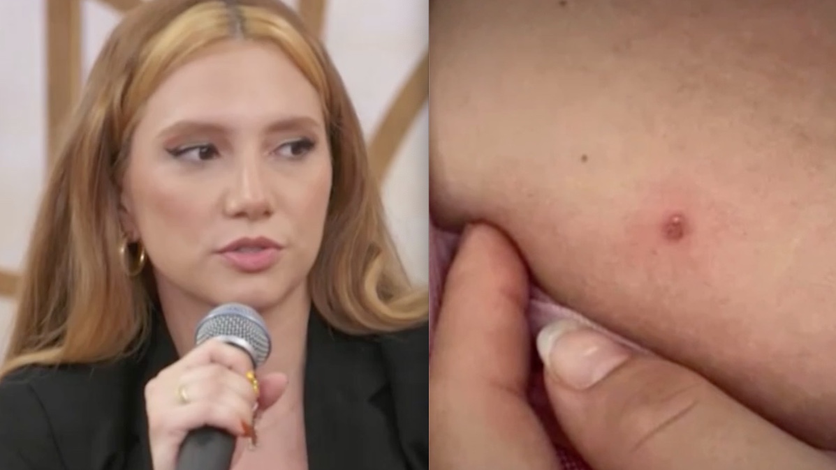 Atriz da Globo conta que descobriu câncer após brincadeira 