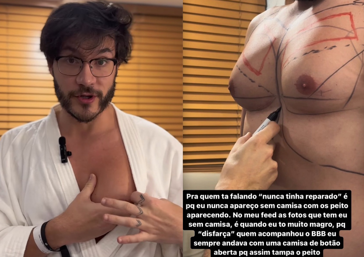 Ex-BBB Eliezer faz cirurgia de redução de mamas