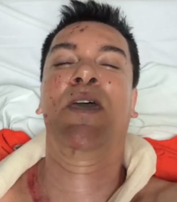 Regis Danese teve perfuração no intestino, diz filho do cantor 