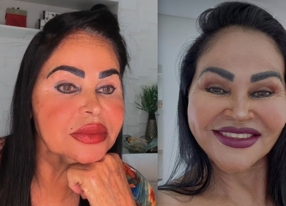 Mãe do cantor Eduardo Costa chama atenção por aparência e nega harmonização