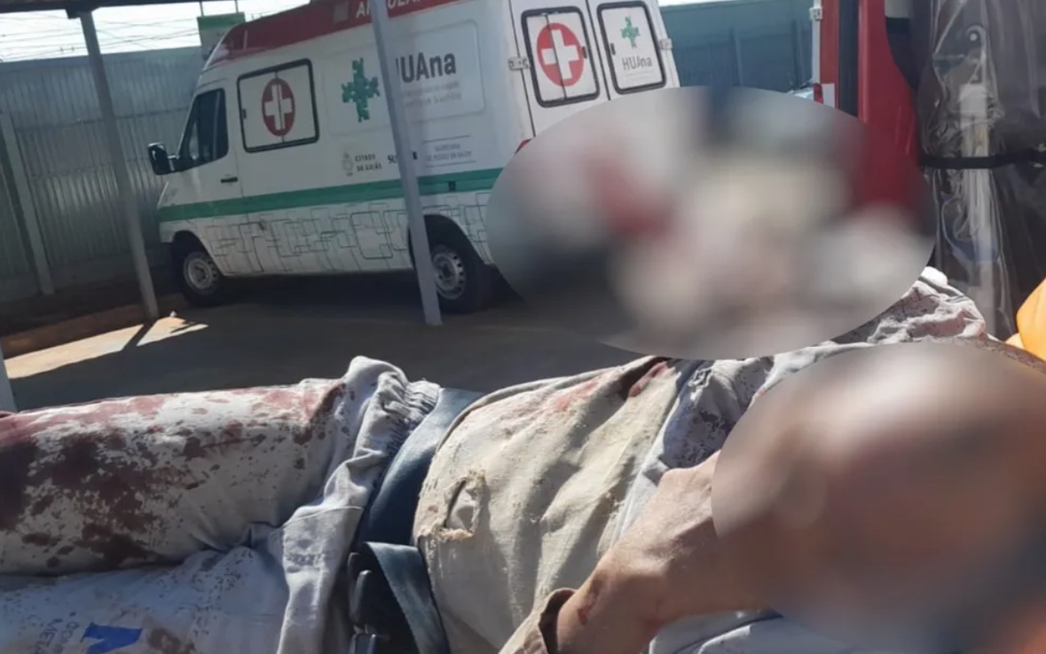 Metalúrgico tem parte do braço arrancado após ficar prensado em máquina