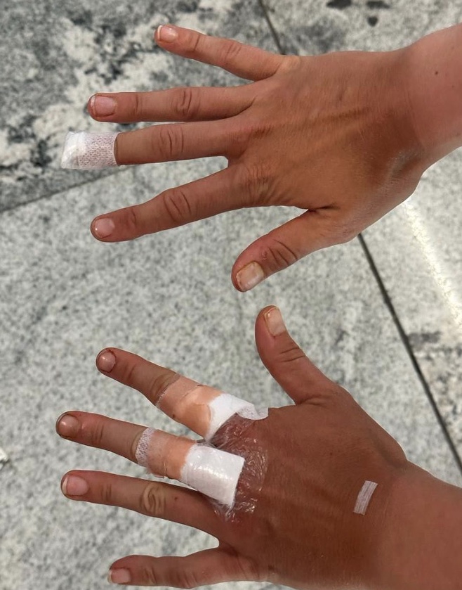 Bia Haddad sofre acidente em banheiro de hotel e desiste de torneio