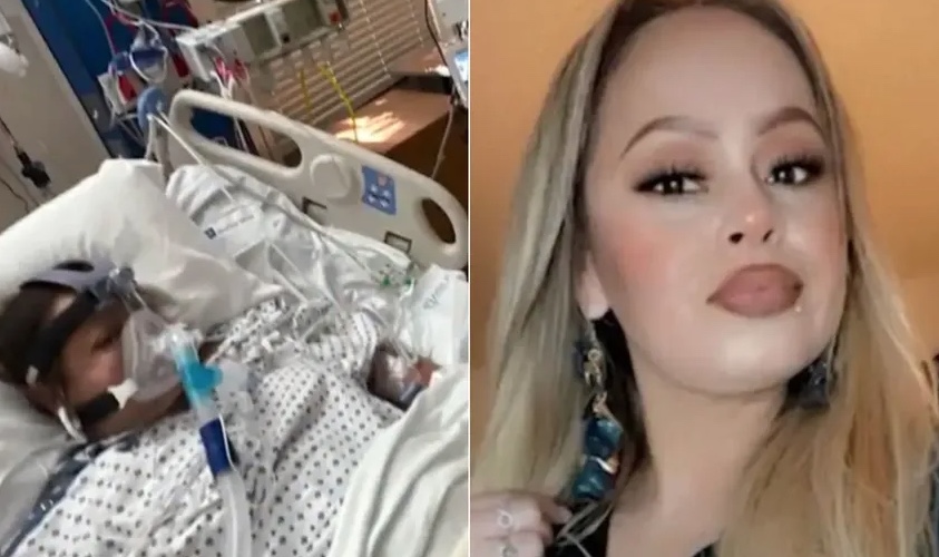 Jovem amputa braços e pernas após comer peixe mal passado