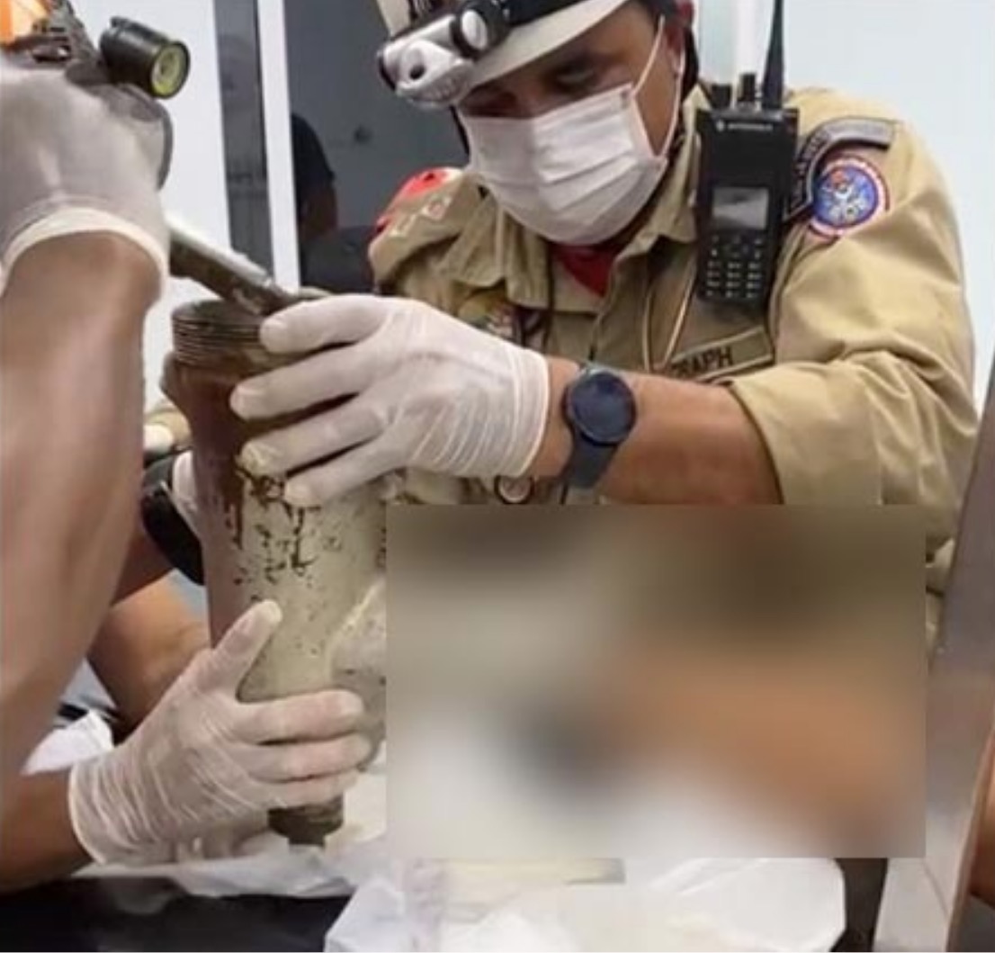 Funcionário de supermercado tem mão triturada em máquina de moer carne em Manaus