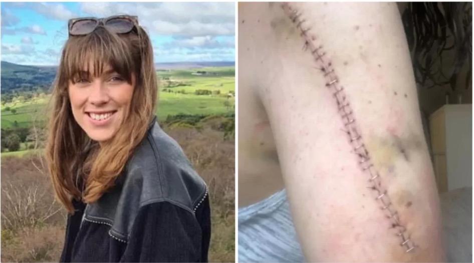 Mulher descobre que não tinha câncer após dois anos de tratamento