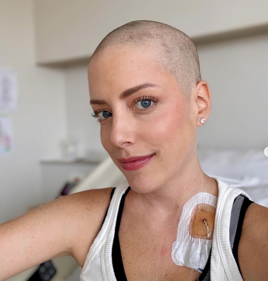 Fabiana Justus raspa os cabelos em tratamento contra leucemia 