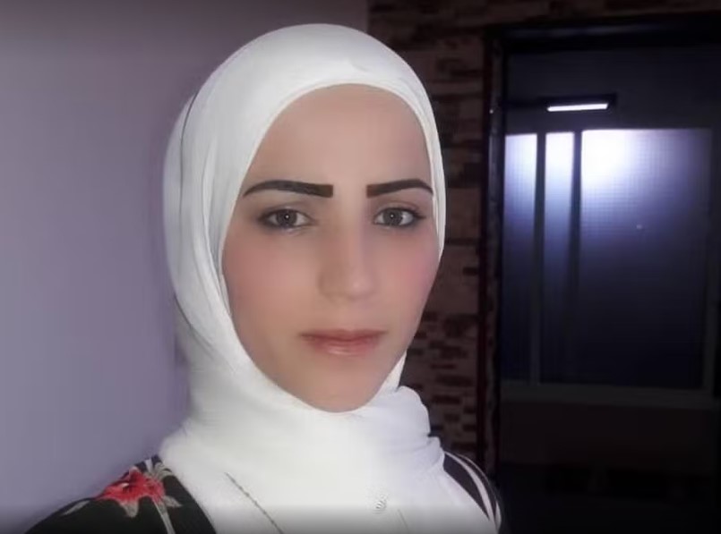 Brasileira fica com rosto desfigurado após bombardeio no Líbano