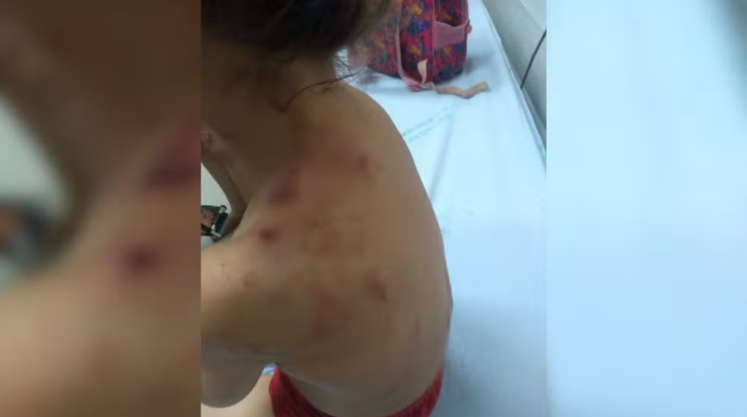 Pit bulls pulam cerca e atacam três crianças