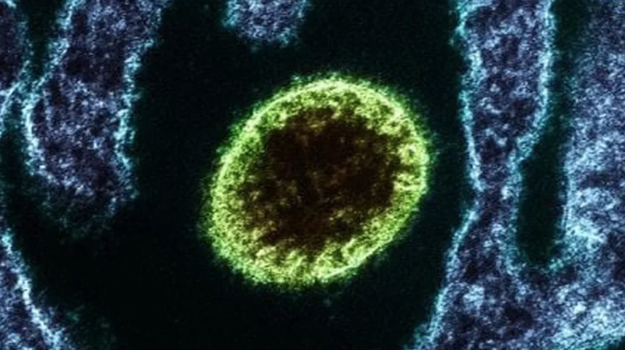 Entenda o que é Nipah vírus, doença que acendeu alerta após morte de adolescente na Índia