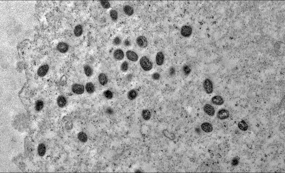OMS convoca reunião para reavaliar emergência em Mpox     