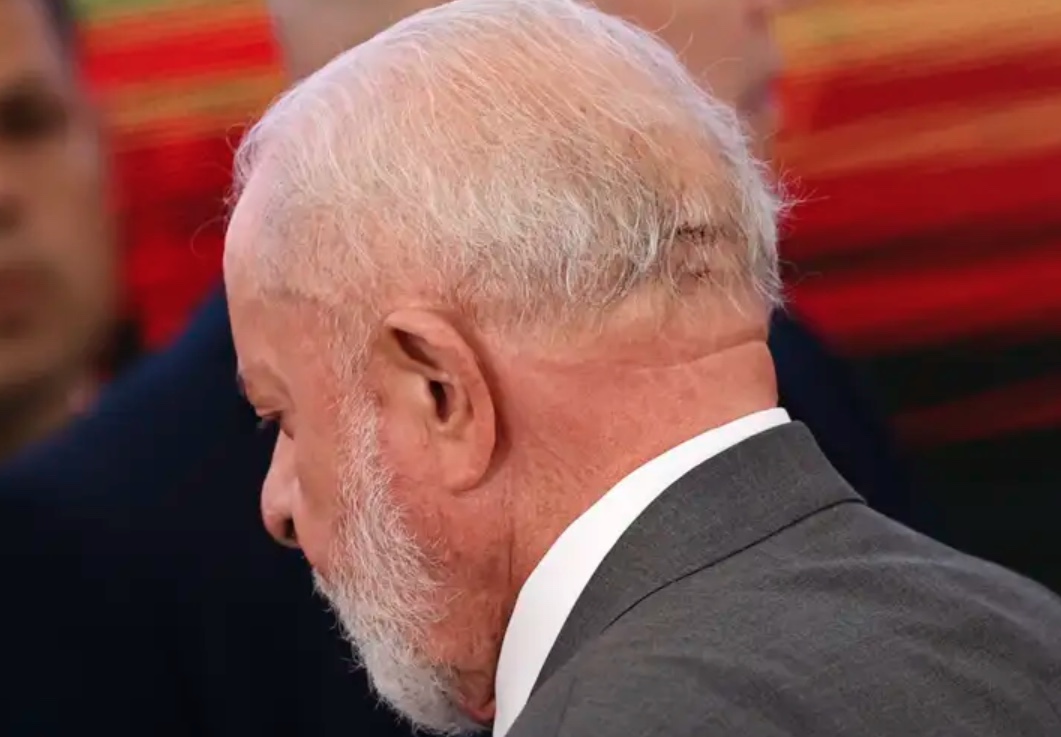 Lula passará por novo procedimento para complementar cirurgia na cabeça