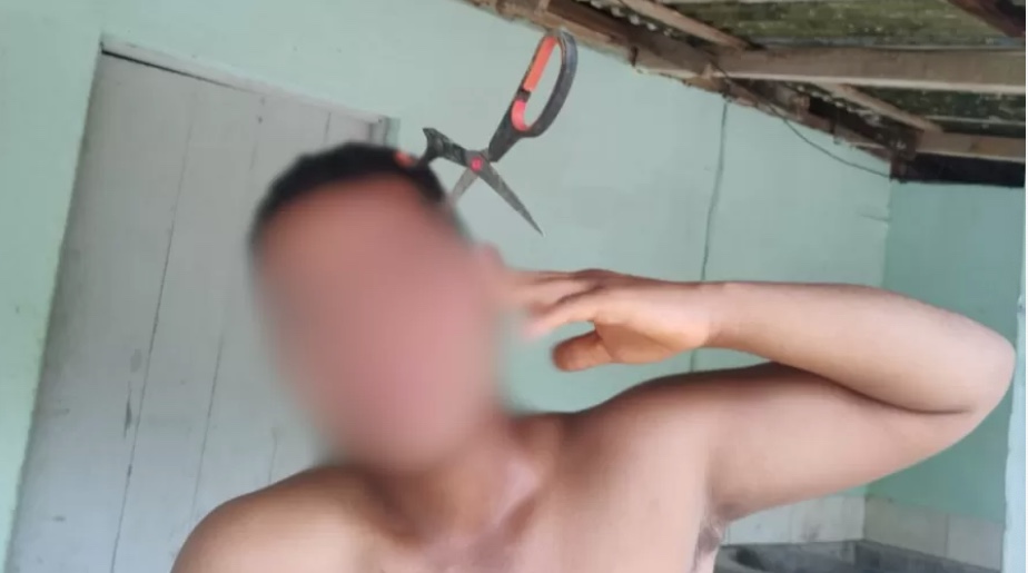 Homem fica com tesoura cravada na cabeça após tentar separar briga