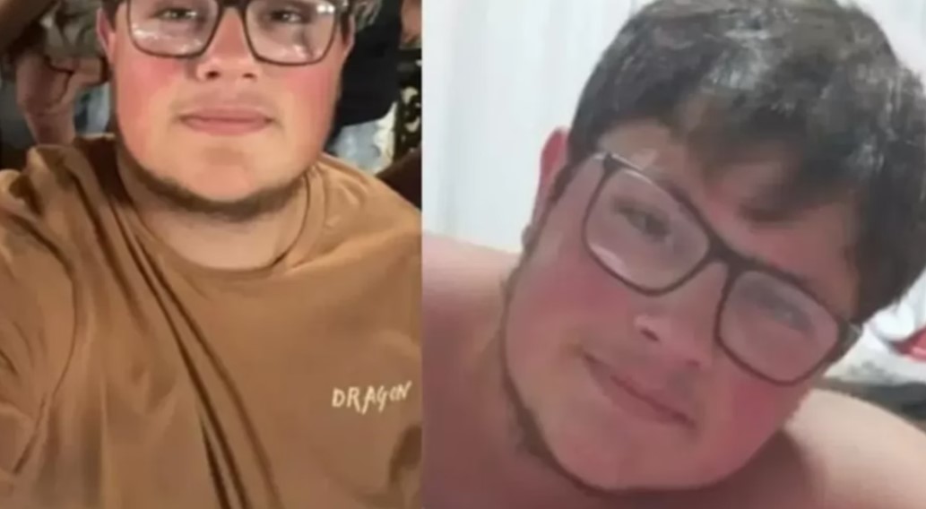 Turista argentino morre após ser atingido por raio em praia de RS