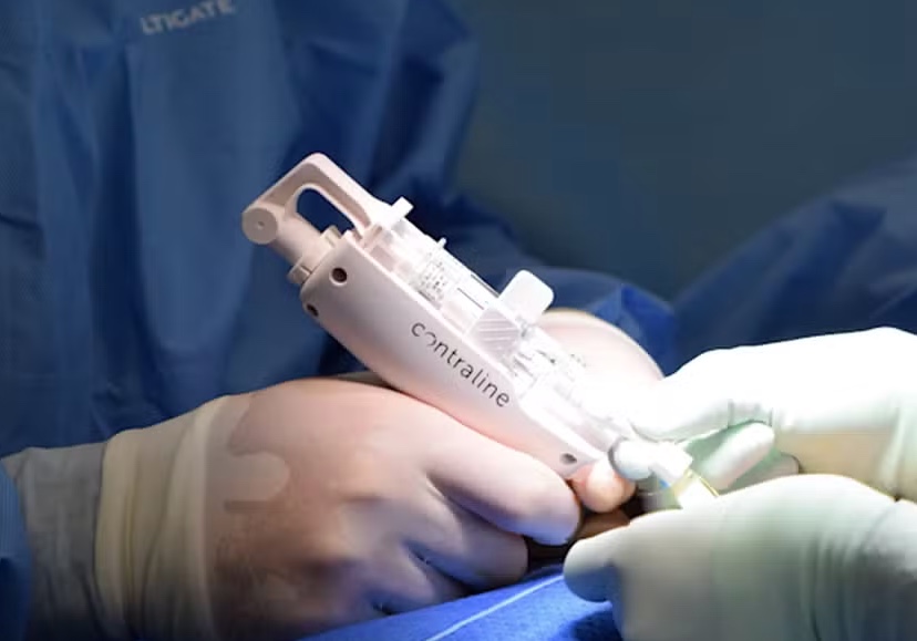 Anticoncepcional que bloqueia esperma tem previsão de lançamento em 2028